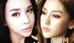 整形天后在线观看,揭秘美丽背后的秘密